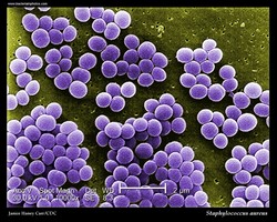 Staphylococcus aureus SEM micrograph